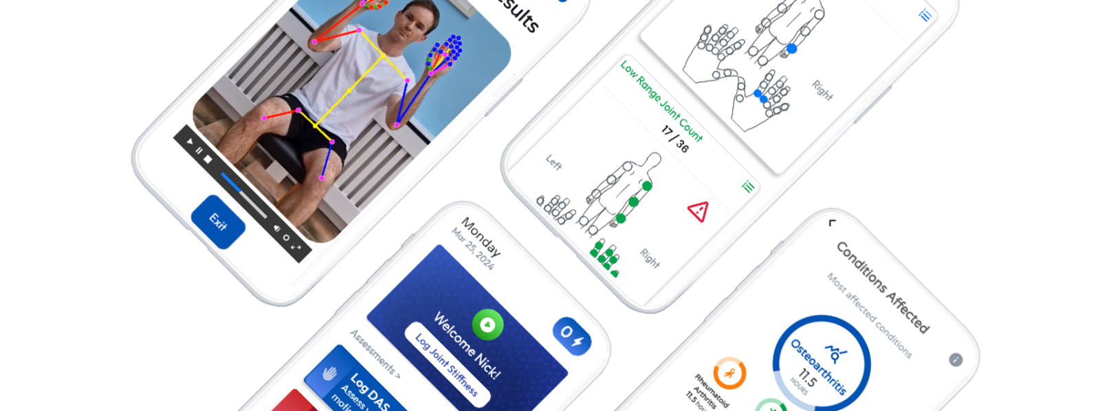 REST - AI for Arthritis
