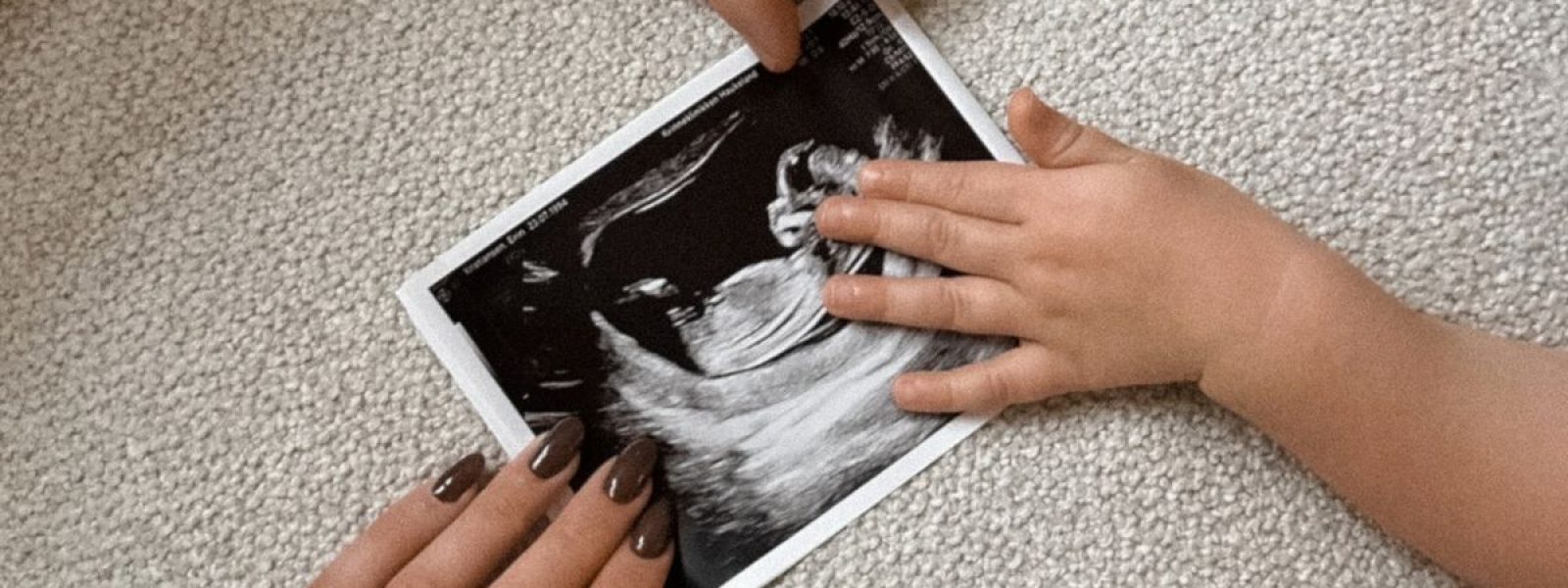 MA MATERNITÉ EN 360°